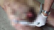 Imagem Mulher decepa pênis de homem que alegava exorcismo para cometer estupros