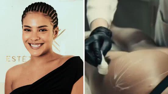 Foto: Reprodução / redes sociais @jkesteticaavancadarj