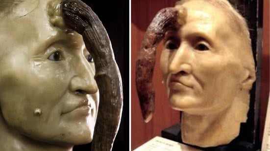 Reprodução / Mütter Museum / Redes Sociais