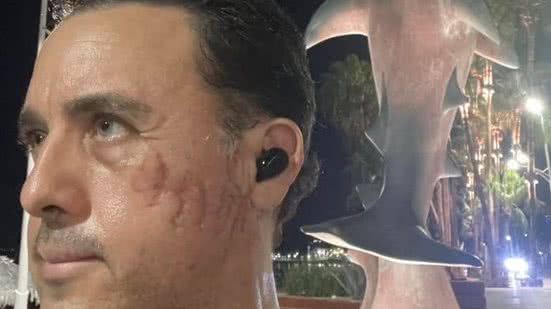 Reprodução Instagram