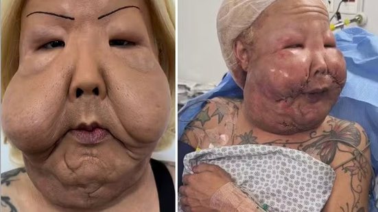 Reprodução Instagram