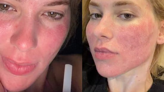 Reprodução Instagram