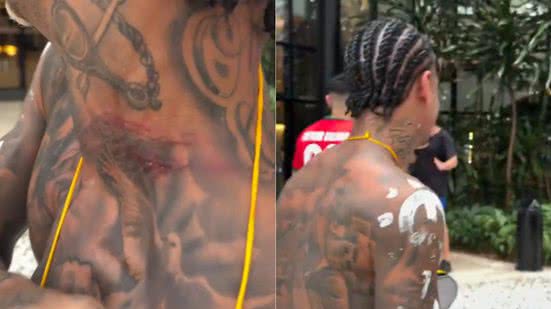 Reprodução/Redes Sociais