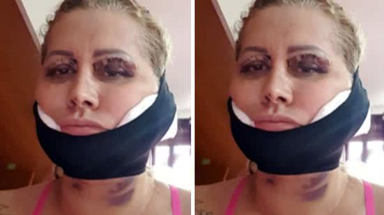 Reprodução | Redes Sociais