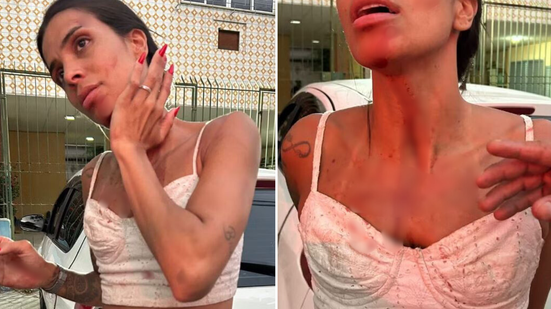 Reprodução/Redes Sociais/com edições do BNews no Canva