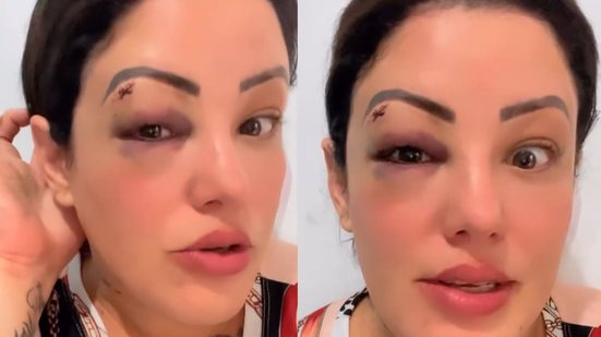 Reprodução Redes Sociais