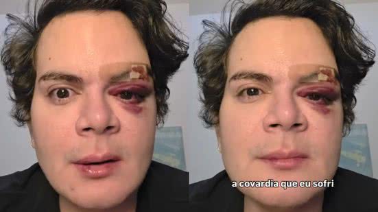 Reprodução/Redes Sociais