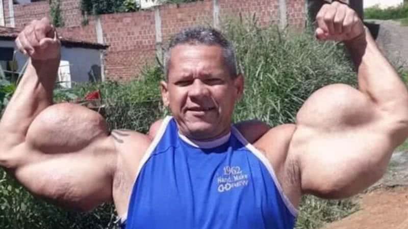 Reprodução/Redes Sociais