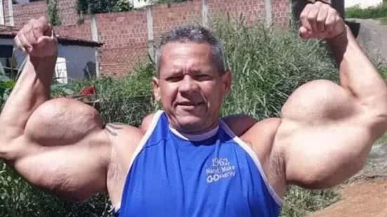 Reprodução/Redes Sociais