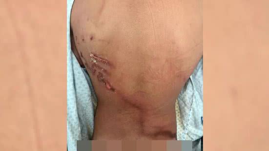 Reprodução/Metropóles