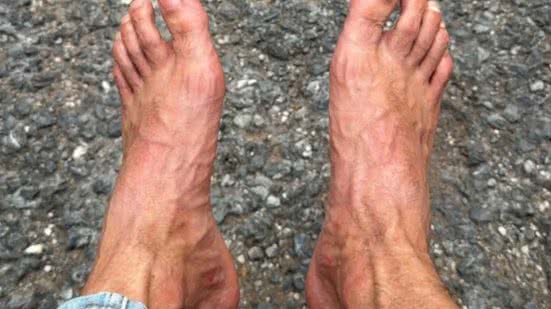Imagem Nikolas Ferreira faz revelação sobre estado de saúde após iniciar caminhada de 200 km: "sintomas de algo muito mais profundo"