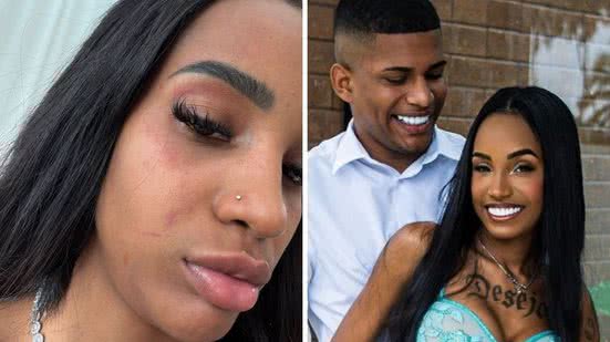 Foto: Reprodução / redes sociais