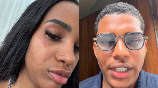 Reprodução/Redes Sociais