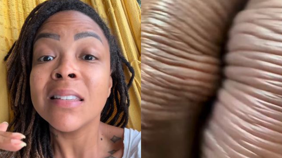 Reprodução Redes sociais