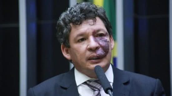 Paulo Sergio/Agência Câmara