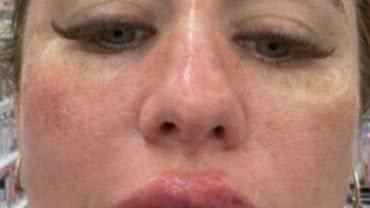 Reprodução Redes sociais