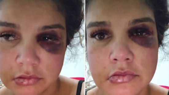 Reprodução / Redes Sociais