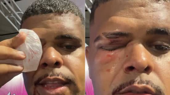 Reprodução/Redes Sociais