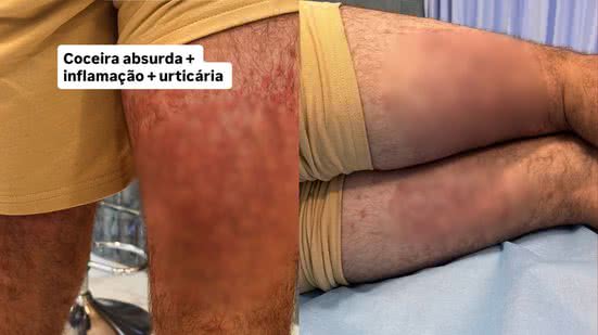Reprodução / Redes Sociais