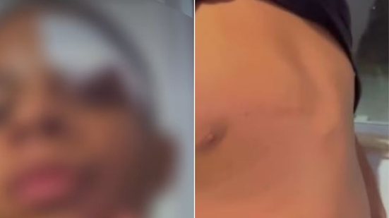 Reprodução/Redes Sociais