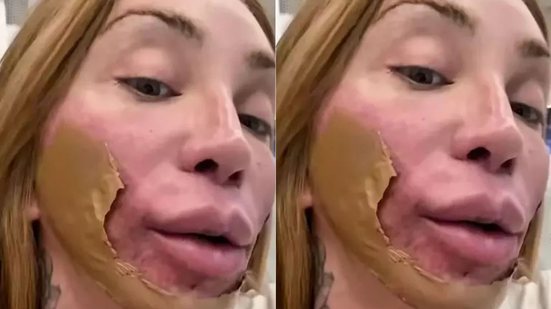 Reprodução/Redes Sociais