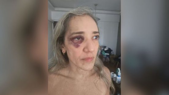 Reprodução/TV Globo