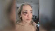 Reprodução/TV Globo