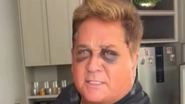 Reprodução Redes Sociais