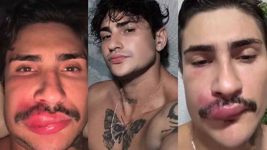 Reprodução/Redes Sociais