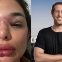 Reprodução / Redes Sociais