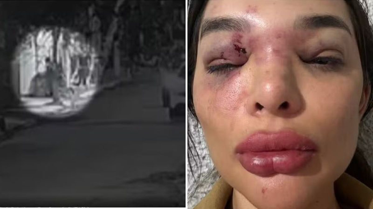 Seguranças são investigados após esposa ser agredida pelo empresário Ivo Vel Kos na porta de casa: 