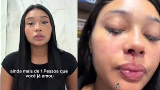 Reprodução / Redes Sociais