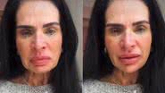 Foto: Reprodução / redes sociais