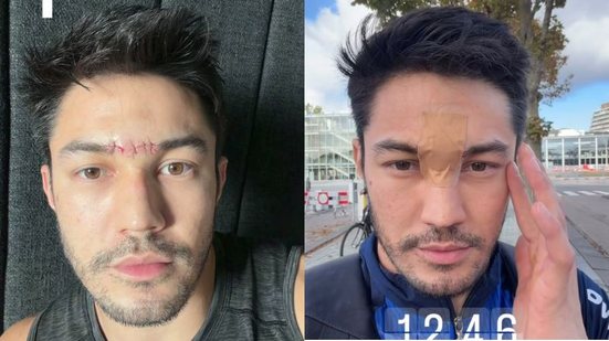 Reprodução/Redes Sociais