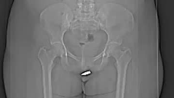 Divulgação/Hospital Erdoğan