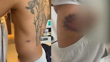 Reprodução/Redes Sociais