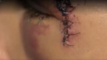 Reprodução/TV Subaé