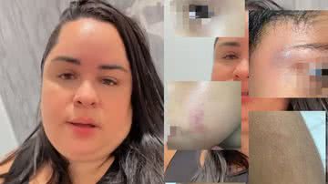 Reprodução/Redes Sociais - Montagem/BNews