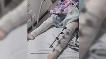 Reprodução/Redes sociais