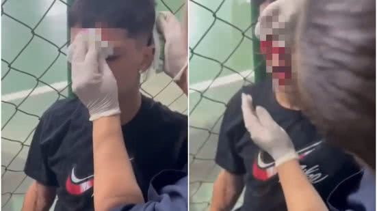 Reprodução/Redes sociais