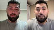 Reprodução / Redes Sociais