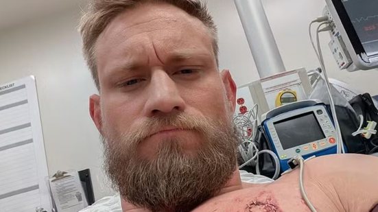 Imagem Ex-lutador do UFC é esfaqueado ao sair de casa e nocauteia agressor; saiba detalhes