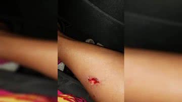 Reprodução / Metrópoles