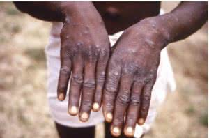 Reprodução Instituto Butantan- Ministério da Saúde