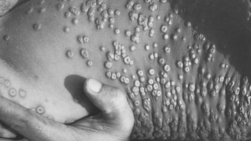 Reprodução/Getty Imagens