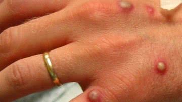 Reprodução/Redes Sociais