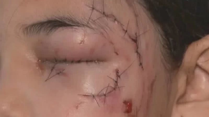 Reprodução/TV Globo
