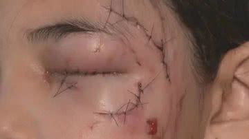 Reprodução/TV Globo