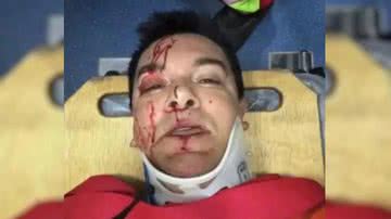 Reprodução/Redes Sociais