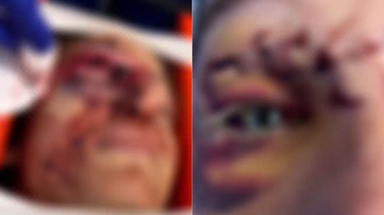 Reprodução/Redes Sociais